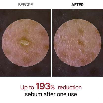 Dr.Melaxin Peel Shot Glow Black Rice Ampoule